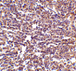 Immunohistochemistry - RP105 Antibody from Signalway Antibody (24424) - Antibodies.com