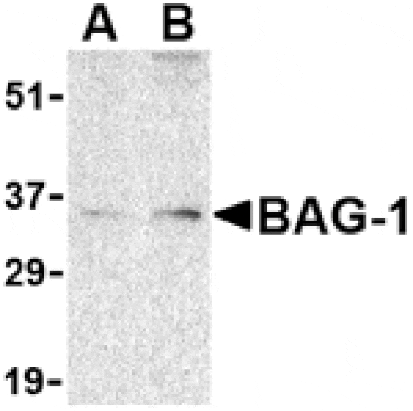 Western blot - BAG-1 Antibody from Signalway Antibody (24434) - Antibodies.com