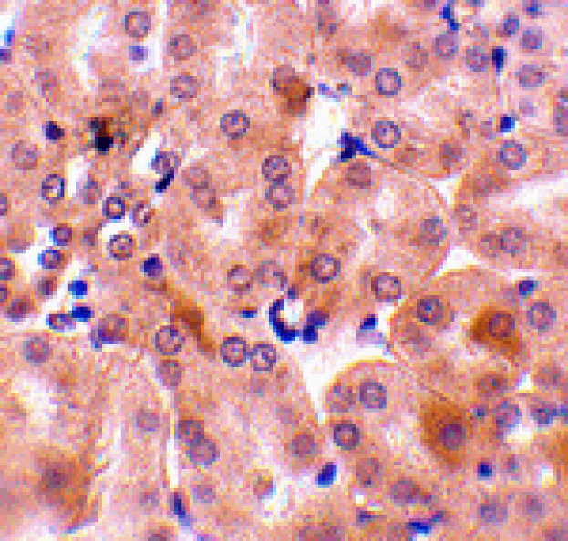 Immunohistochemistry - Bfl-1 Antibody from Signalway Antibody (24435) - Antibodies.com