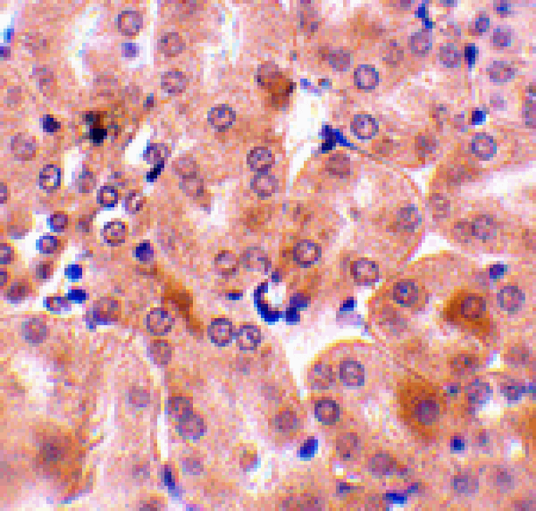 Immunohistochemistry - Bfl-1 Antibody from Signalway Antibody (24435) - Antibodies.com