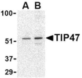 Western blot - TIP47 Antibody from Signalway Antibody (24439) - Antibodies.com