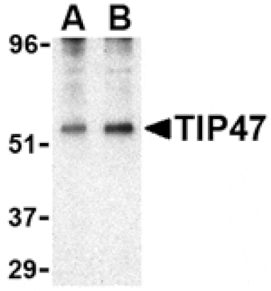 Western blot - TIP47 Antibody from Signalway Antibody (24440) - Antibodies.com