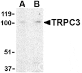Western blot - TRPC3 Antibody from Signalway Antibody (24443) - Antibodies.com