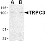 Western blot - TRPC3 Antibody from Signalway Antibody (24443) - Antibodies.com