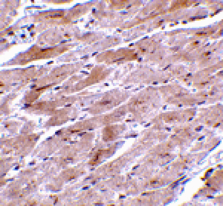 Immunohistochemistry - TRPC3 Antibody from Signalway Antibody (24443) - Antibodies.com