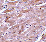 Immunohistochemistry - TRPC3 Antibody from Signalway Antibody (24443) - Antibodies.com