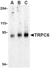 Western blot - TRPC6 Antibody from Signalway Antibody (24444) - Antibodies.com