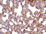 Immunohistochemistry - TRPC6 Antibody from Signalway Antibody (24444) - Antibodies.com