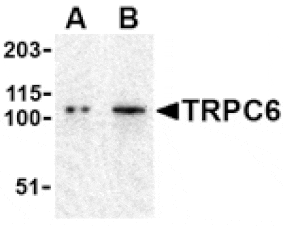 Western blot - TRPC6 Antibody from Signalway Antibody (24445) - Antibodies.com