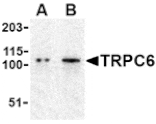 Western blot - TRPC6 Antibody from Signalway Antibody (24445) - Antibodies.com