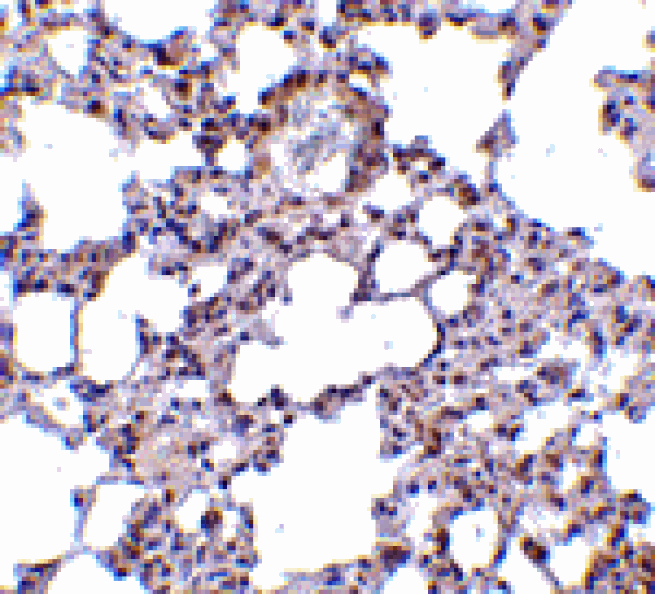 Immunohistochemistry - TRPC6 Antibody from Signalway Antibody (24445) - Antibodies.com