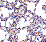 Immunohistochemistry - TRPC6 Antibody from Signalway Antibody (24445) - Antibodies.com