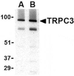 Western blot - TRPC3 Antibody from Signalway Antibody (24448) - Antibodies.com