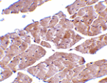 Immunohistochemistry - TRPC3 Antibody from Signalway Antibody (24448) - Antibodies.com