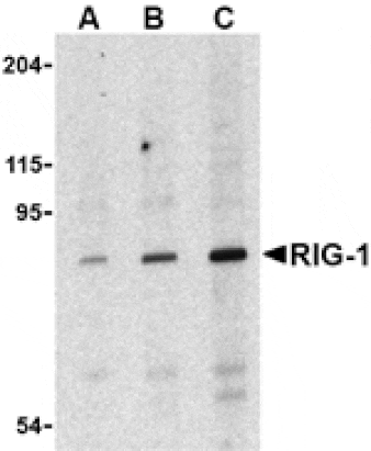Western blot - RIG-1 Antibody from Signalway Antibody (24461) - Antibodies.com