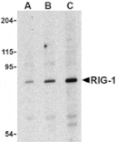 Western blot - RIG-1 Antibody from Signalway Antibody (24461) - Antibodies.com