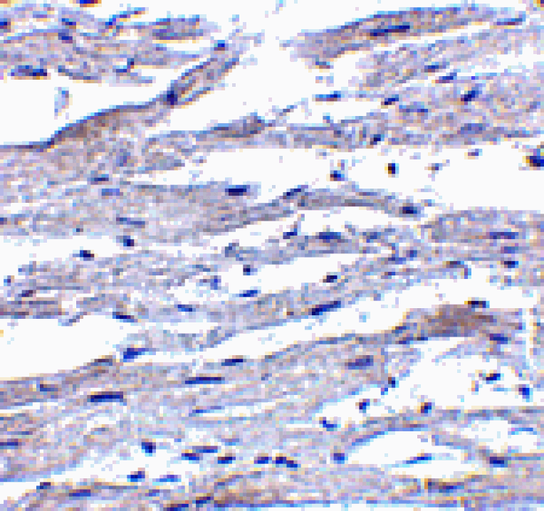 Immunohistochemistry - RIG-1 Antibody from Signalway Antibody (24461) - Antibodies.com