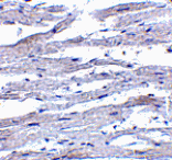 Immunohistochemistry - RIG-1 Antibody from Signalway Antibody (24461) - Antibodies.com