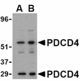 Western blot - PDCD4 Antibody from Signalway Antibody (24468) - Antibodies.com