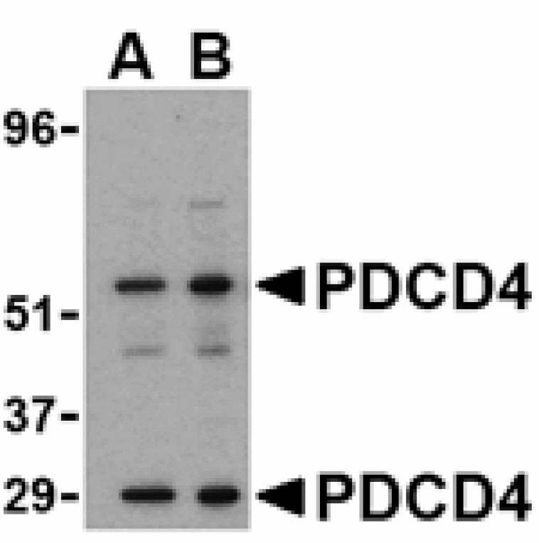 Western blot - PDCD4 Antibody from Signalway Antibody (24468) - Antibodies.com