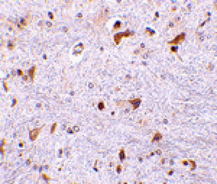 Immunohistochemistry - PDCD4 Antibody from Signalway Antibody (24468) - Antibodies.com