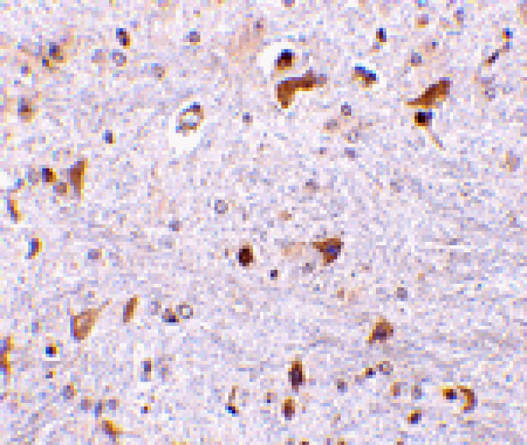 Immunohistochemistry - PDCD4 Antibody from Signalway Antibody (24468) - Antibodies.com