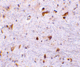 Immunohistochemistry - PDCD4 Antibody from Signalway Antibody (24468) - Antibodies.com