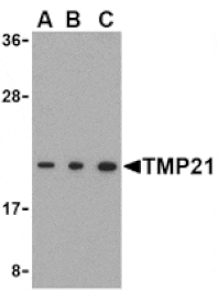 Western blot - TMP21 Antibody from Signalway Antibody (24477) - Antibodies.com
