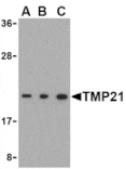 Western blot - TMP21 Antibody from Signalway Antibody (24477) - Antibodies.com