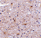 Immunohistochemistry - TMP21 Antibody from Signalway Antibody (24477) - Antibodies.com