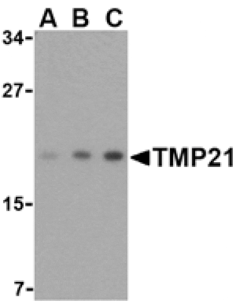 Western blot - TMP21 Antibody from Signalway Antibody (24478) - Antibodies.com