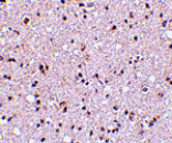Immunohistochemistry - TMP21 Antibody from Signalway Antibody (24478) - Antibodies.com