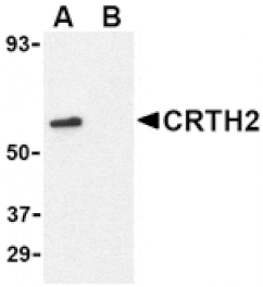 Western blot - CRTH2 Antibody from Signalway Antibody (24489) - Antibodies.com