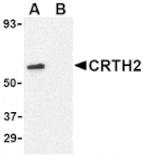 Western blot - CRTH2 Antibody from Signalway Antibody (24489) - Antibodies.com