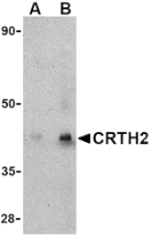 Western blot - CRTH2 Antibody from Signalway Antibody (24490) - Antibodies.com