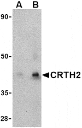 Western blot - CRTH2 Antibody from Signalway Antibody (24490) - Antibodies.com