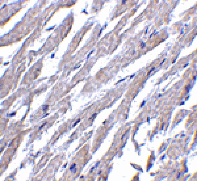 Immunohistochemistry - CRTH2 Antibody from Signalway Antibody (24490) - Antibodies.com
