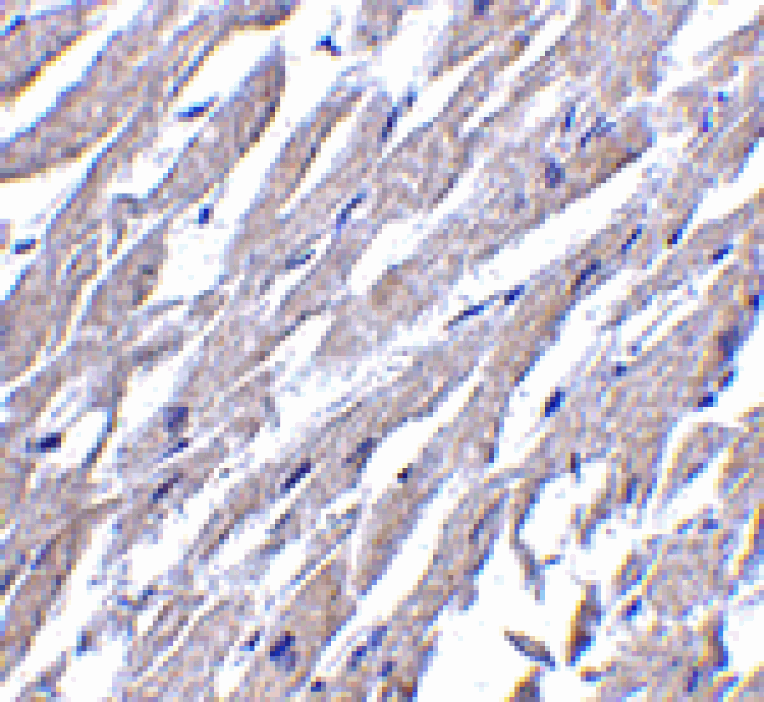 Immunohistochemistry - CRTH2 Antibody from Signalway Antibody (24490) - Antibodies.com