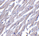 Immunohistochemistry - CRTH2 Antibody from Signalway Antibody (24490) - Antibodies.com
