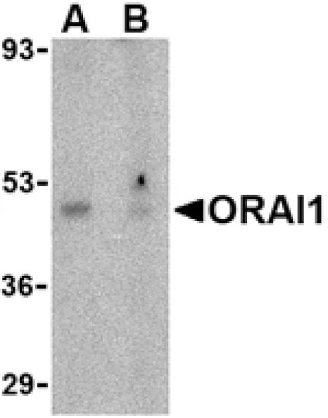 Western blot - ORAI1 Antibody from Signalway Antibody (24496) - Antibodies.com
