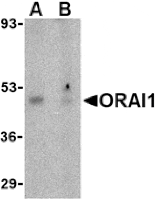 Western blot - ORAI1 Antibody from Signalway Antibody (24496) - Antibodies.com