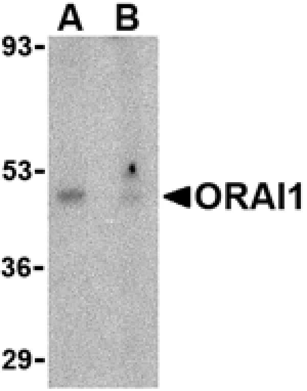 Western blot - ORAI1 Antibody from Signalway Antibody (24496) - Antibodies.com