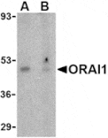 Western blot - ORAI1 Antibody from Signalway Antibody (24496) - Antibodies.com