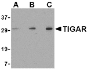 Western blot - TIGAR Antibody from Signalway Antibody (24499) - Antibodies.com