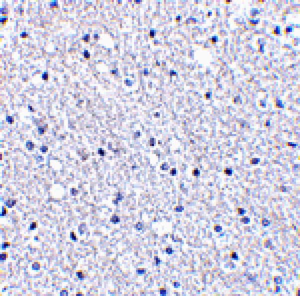 Immunohistochemistry - TIGAR Antibody from Signalway Antibody (24499) - Antibodies.com