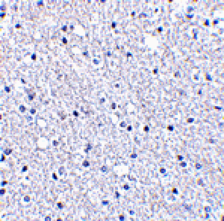 Immunohistochemistry - TIGAR Antibody from Signalway Antibody (24499) - Antibodies.com