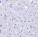 Immunohistochemistry - TIGAR Antibody from Signalway Antibody (24499) - Antibodies.com