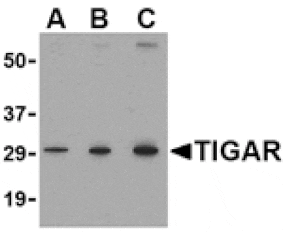 Western blot - TIGAR Antibody from Signalway Antibody (24500) - Antibodies.com