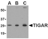 Western blot - TIGAR Antibody from Signalway Antibody (24500) - Antibodies.com