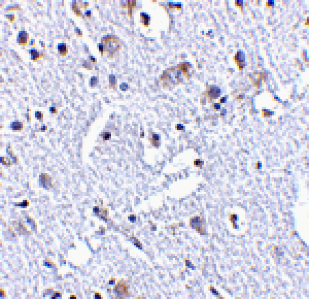 Immunohistochemistry - TIGAR Antibody from Signalway Antibody (24500) - Antibodies.com